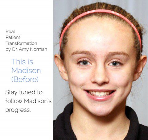 Patient Transformation: Madison