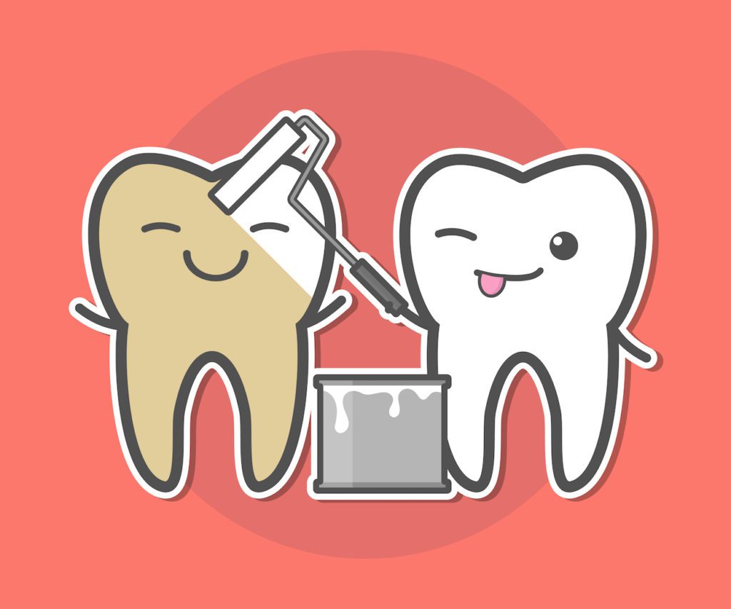 5 Things Everyone Should Know About Teeth Whitening