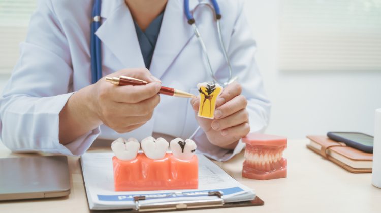Dentist explaining tooth damage with model – Cracked or Chipped Tooth.