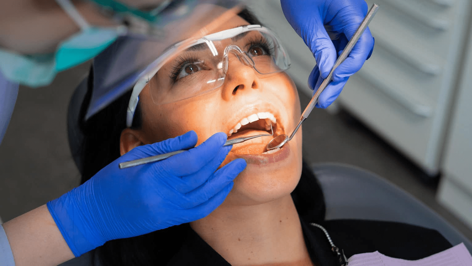 sealants on teeth